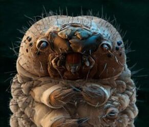 Parasites